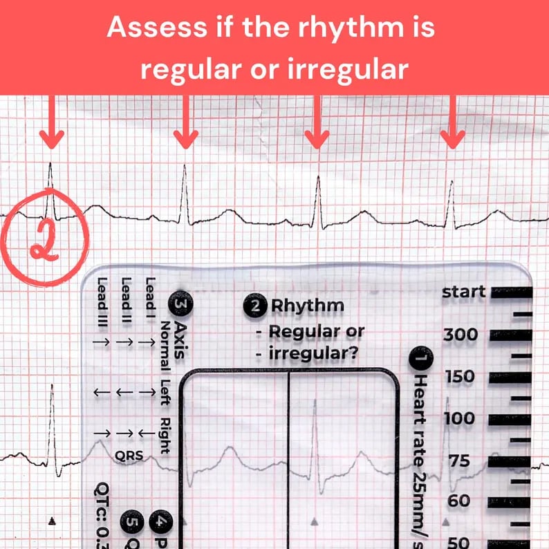 🔥LAST DAY 50% OFF - 🎁ECG 7 Step Ruler