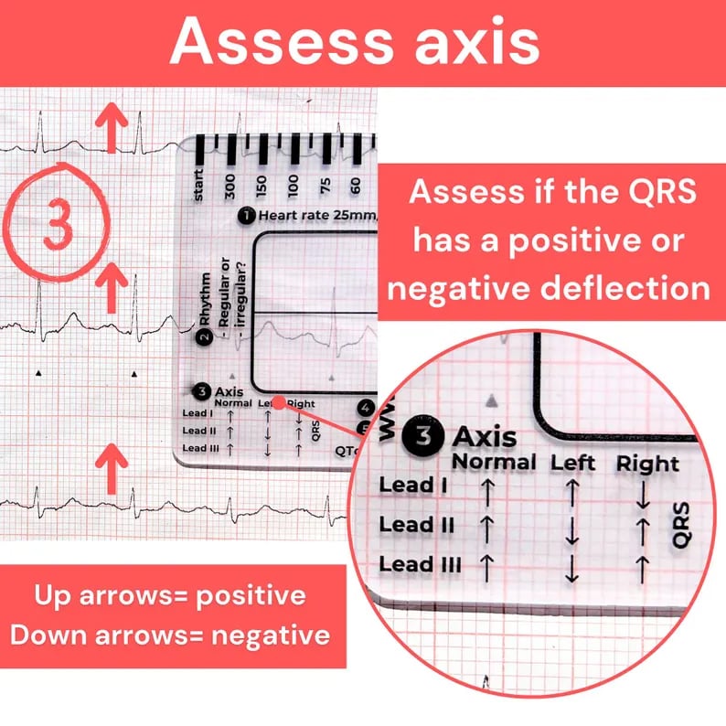 🔥LAST DAY 50% OFF - 🎁ECG 7 Step Ruler