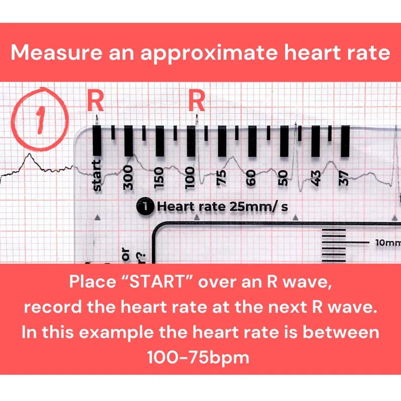 🔥LAST DAY 50% OFF - 🎁ECG 7 Step Ruler